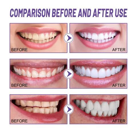 DENTS BLANCHES