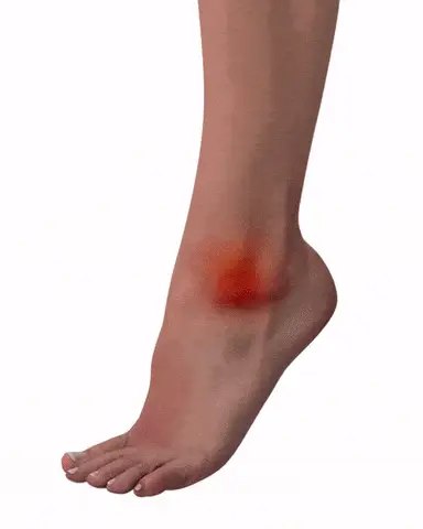 NeuroSocks™ | Pour une Mobilité Accrue et une Vie sans Douleur (Chaussettes de Compression Antidouleur)